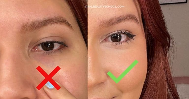 dark circles under eyes fix